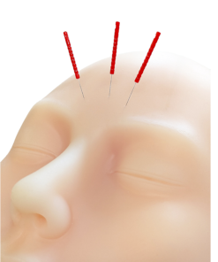 Alternative view of Realistic Facial Model - Silicone, life-size